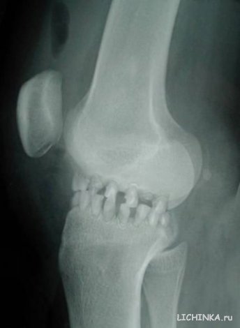 Увеличить картинку